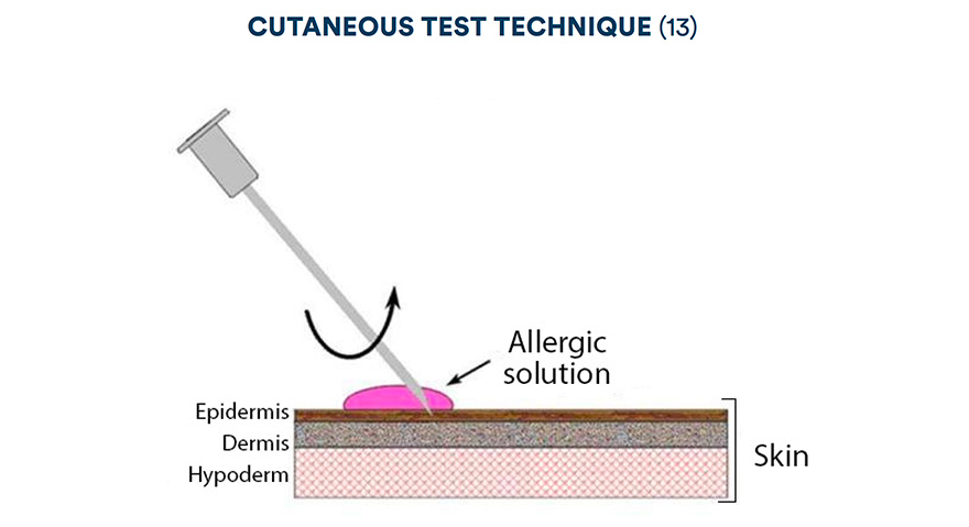 Cutaneous test technique