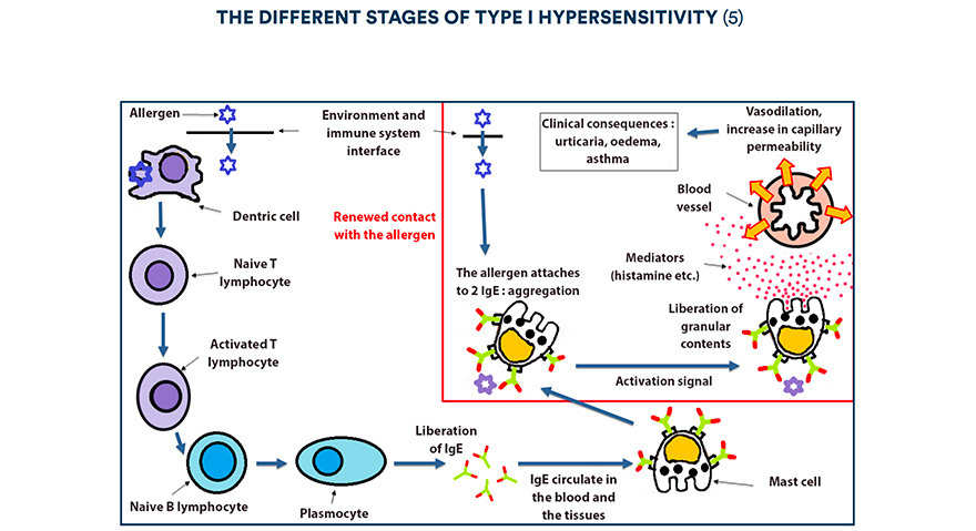 The different stages of type I hypersensitivity (5)