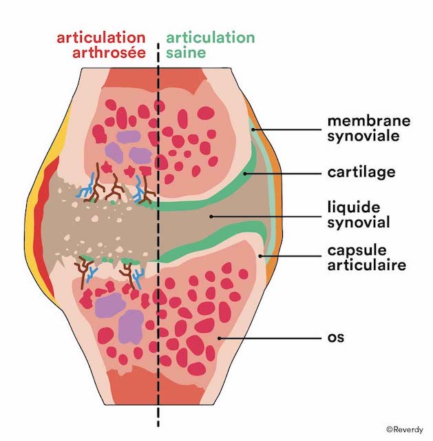 Composition d'une articulation saine VS arthrose chez le cheval