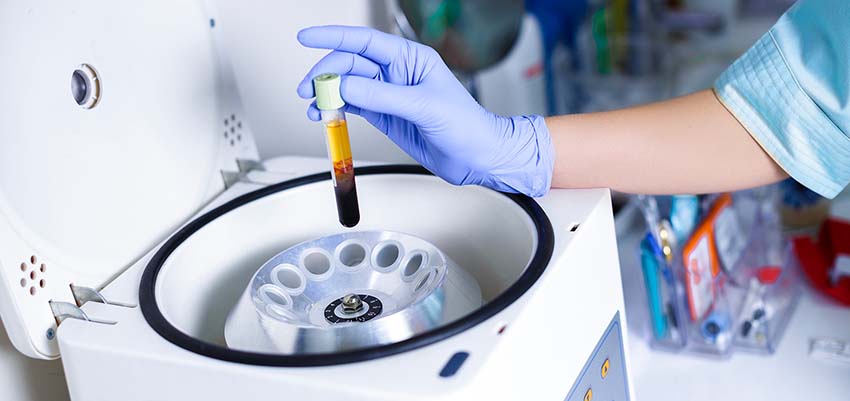 Allergies alimentaires : fiabilité des tests sanguins