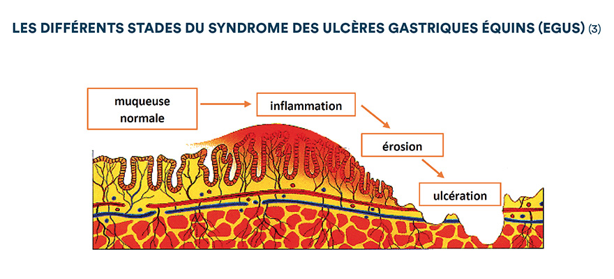 Les différents stades du syndrome des ulcères gastriques équins (EGUS) (3)